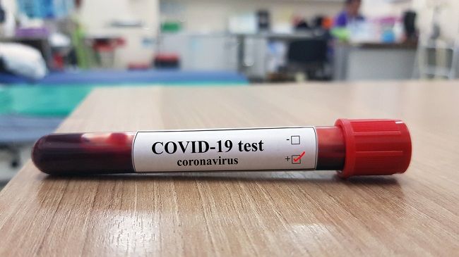 Cari Tahu Penjelasan tentang Rapid Test COVID-19 Positif di Sini