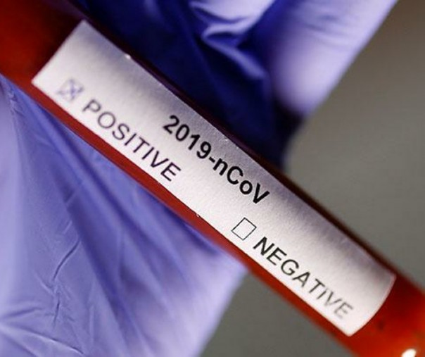 Para Peneliti Temukan Antivirus Corona, Sering Digunakan untuk Penyakit Ebola
